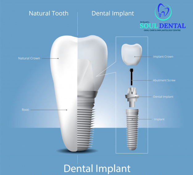 Dr. Swati's Soul Dental