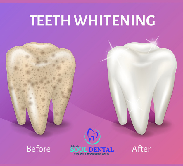 Dr. Swati's Soul Dental